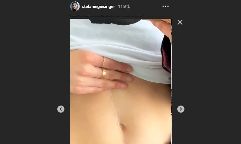 giesinger