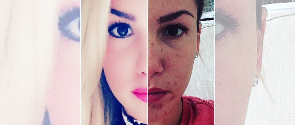 Pickel-Selfie! Angelina Heger zeigt sich ungeschminkt 61 KU 2014 SLIDE940 FREMD 65 BILD facebook