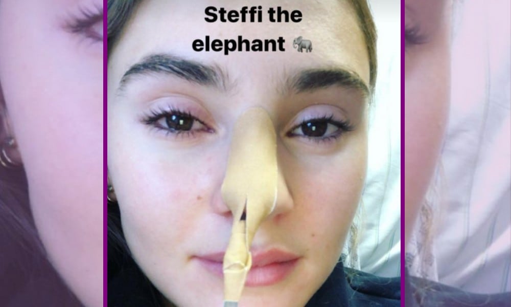 STARS 163 Stefanie Giesinger BILD Facebook