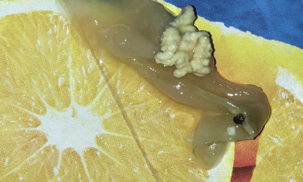 STORY 1 OSaft BILD Twitter