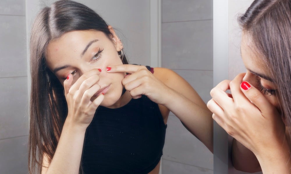 surprised young woman finding acne on her face picture id831176750