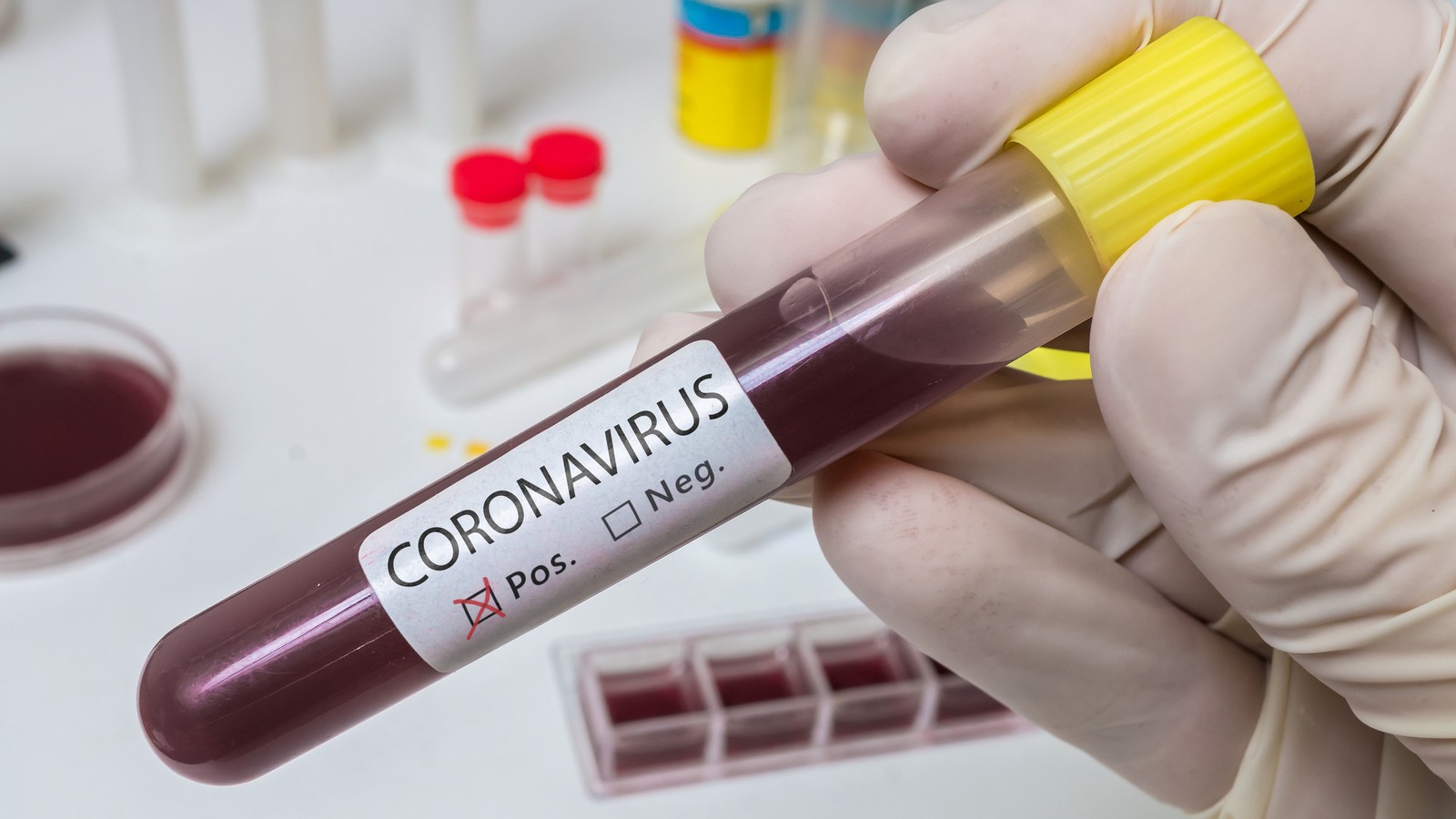 Coronavirus