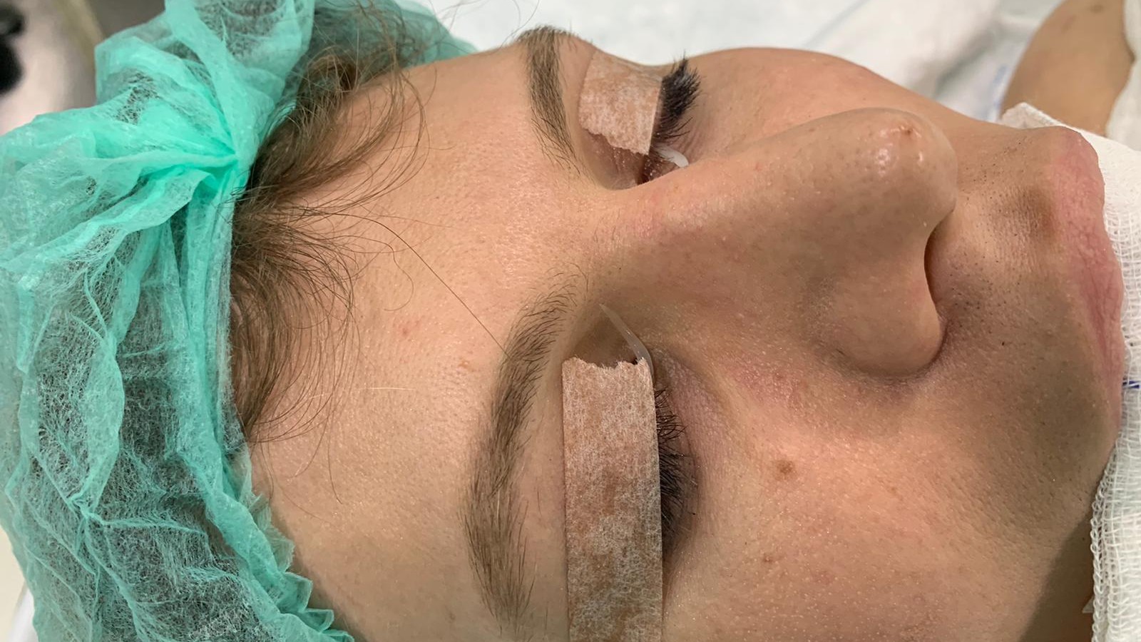 Arielle Rippegather: Erste Bilder! So verlief die Nasen-OP 72 Arielle Rippegather