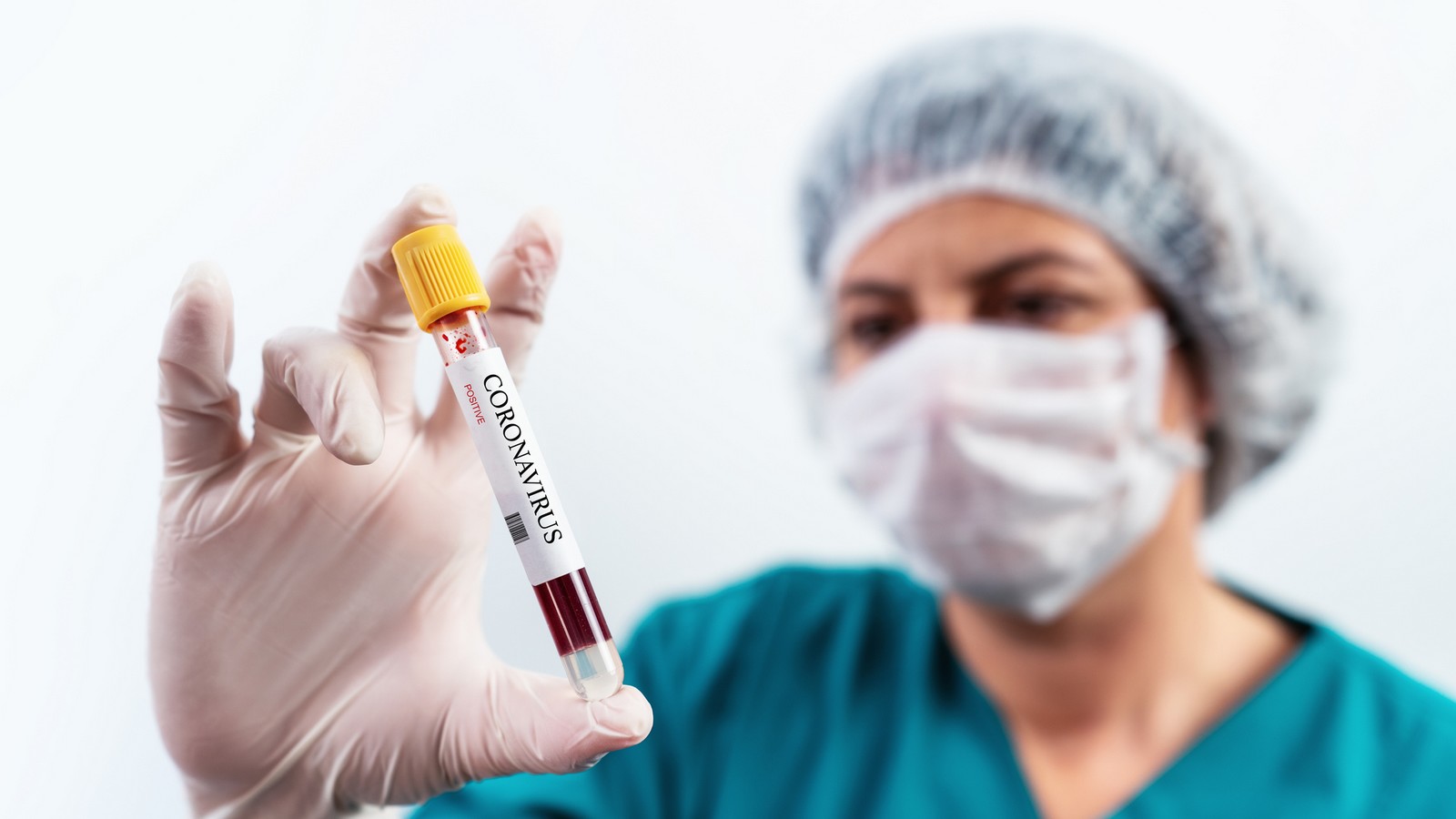 Coronavirus: Wie tödlich ist die Infektion wirklich? 72 Coronavirus