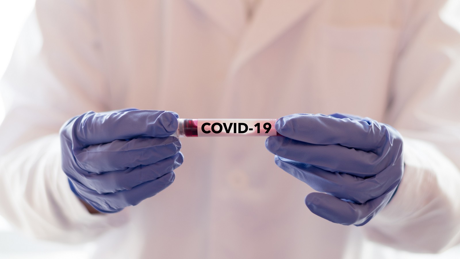 Coronavirus: Das solltest du bei einer Infektion nie tun! 72 Coronavirus
