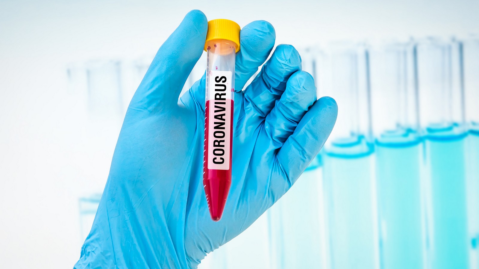 Coronavirus