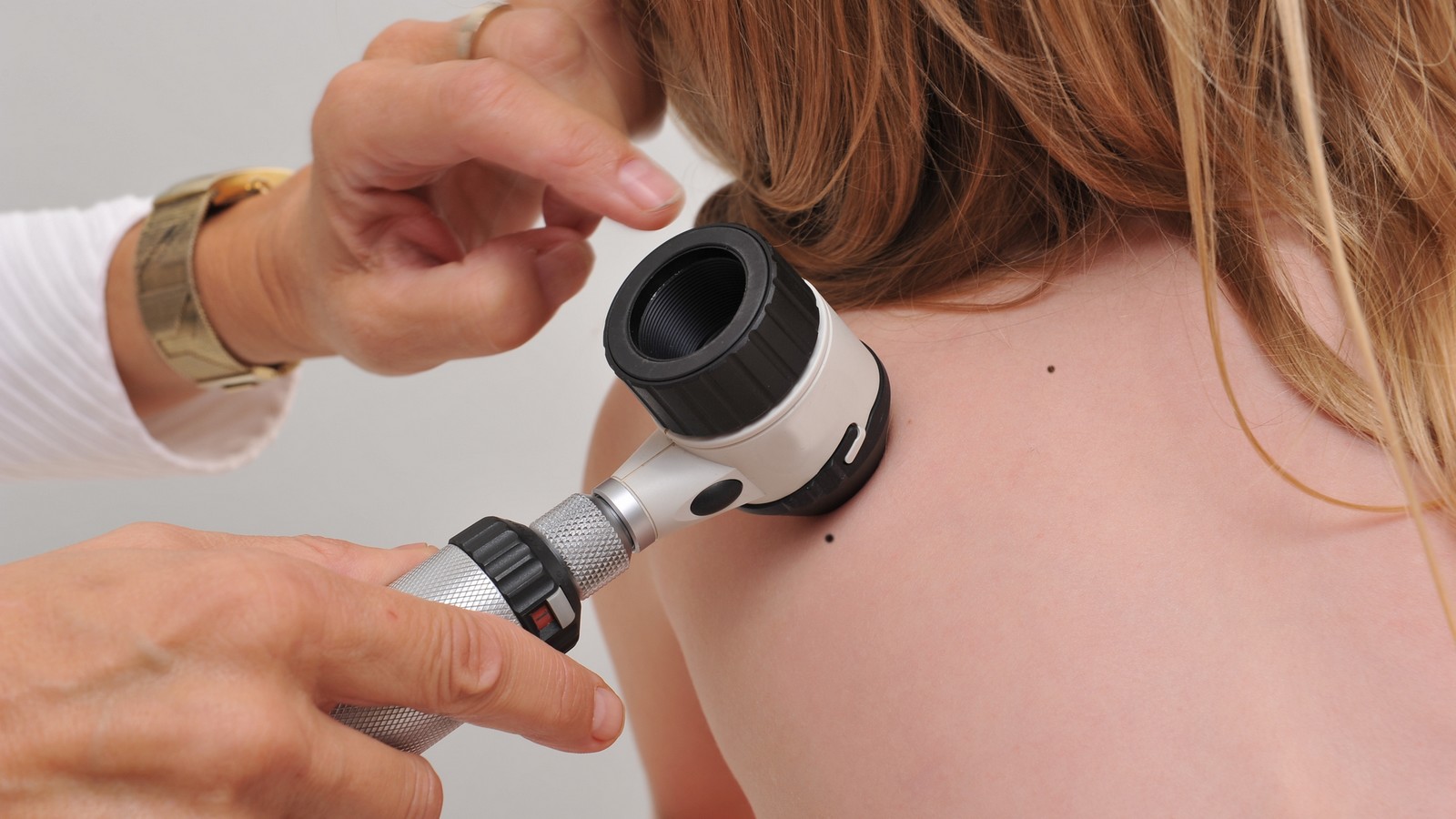 Diese Hautprobleme sind ein neues Corona-Symptom 72 Arzt