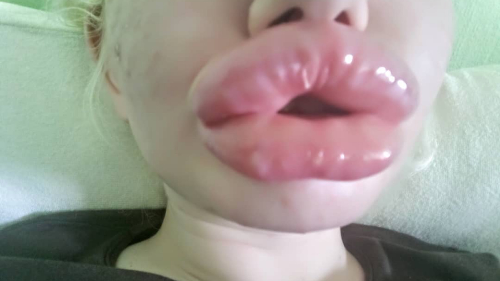Influencerin lässt sich zum 20. Mal die Lippen aufspritzen! 72 Andrea Ivanova