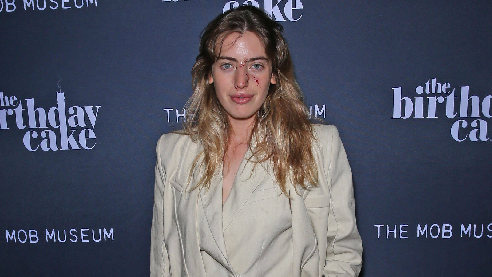 Clara McGregor mit Hundebiss im Gesicht bei Premiere