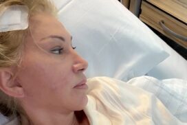 Neurologe erklärt: So läuft die Hirn-OP bei Carmen Geiss ab 67 Neurologe erklärt: So läuft die Hirn-OP bei Carmen Geiss ab