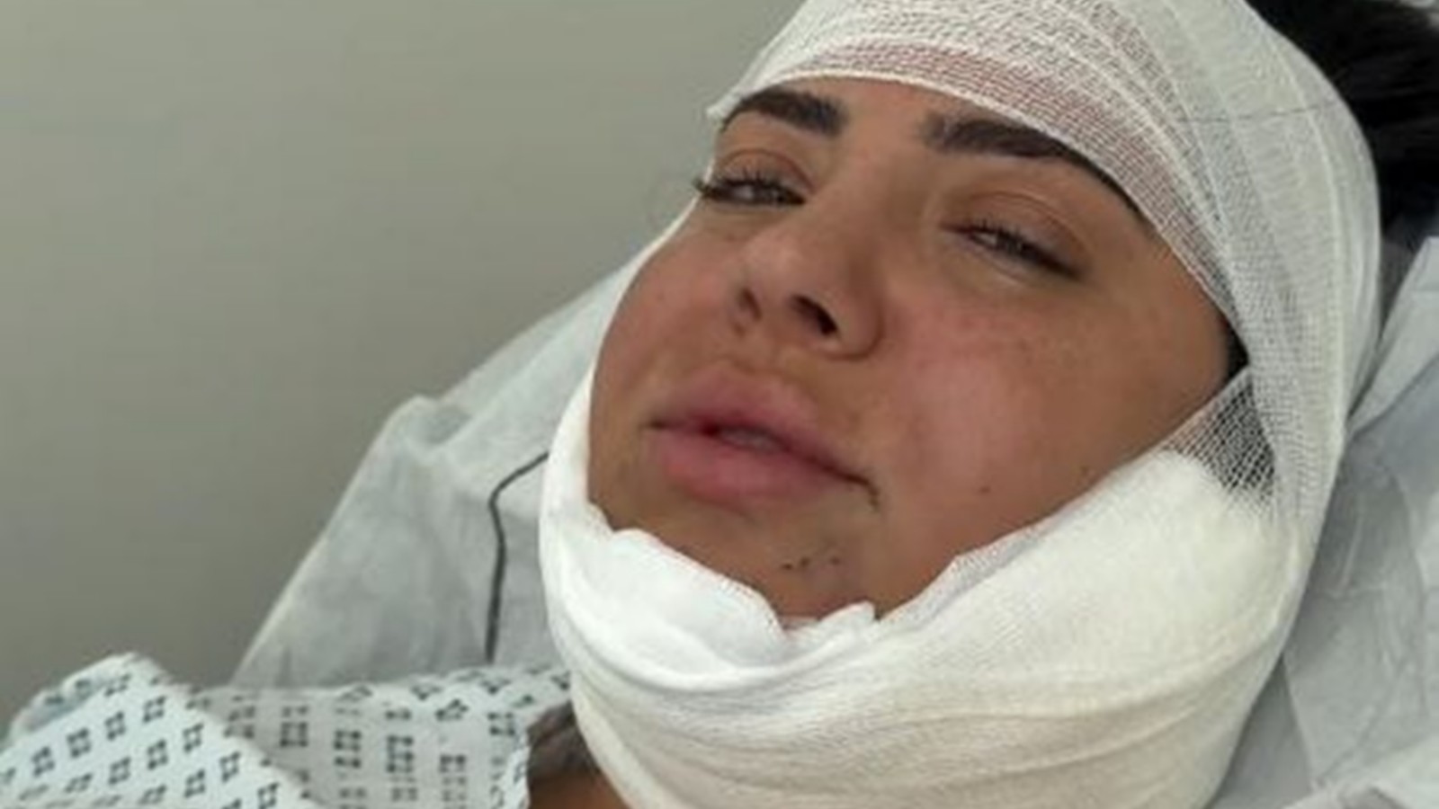 Koch-Clip nach Beauty-OP: Leyla Heiter wehrt sich gegen Kritik 61 Leyla Heiter