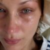 Bella Hadid spricht über ihre Krankheit: "Duschen, ohne ohnmächtig zu werden, ist eine Leistung" 53 Bella Hadid