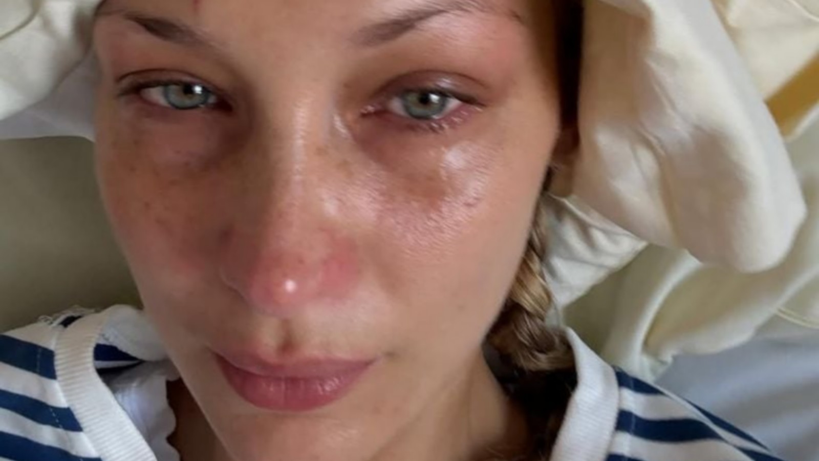 Bella Hadid spricht über ihre Krankheit: "Duschen, ohne ohnmächtig zu werden, ist eine Leistung" 61 Bella Hadid